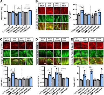 Shank3 related muscular hypotonia is accompanied by increased intracellular calcium concentrations and ion channel dysregulation in striated muscle tissue